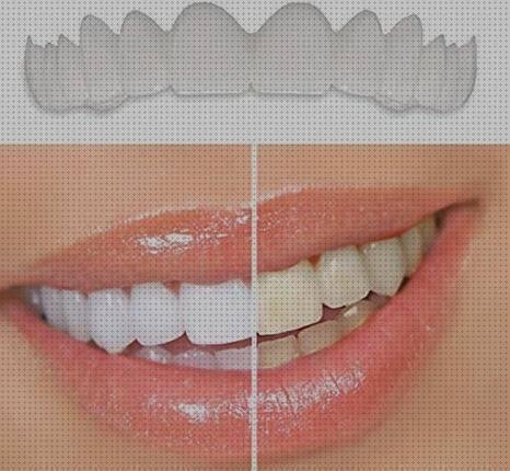 2 Pares Dientes Postizos Temporales, Reutilizable Cómoda Dientes de  Carillas Cosméticos de Superior e Inferior para Hombre Mujer Blanqueamiento  Dental